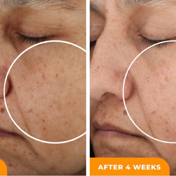 BeautyStat Universal C Skin Refiner - Picture 6 of 12